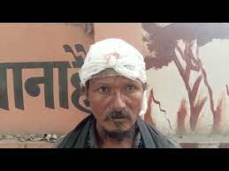 सरकारी नल से पानी पीने पर दलित युवत की पिटाई:रायबरेली में दबंगों ने पहले मना किया, विरोध करने पर सिर पर कुल्हाड़ी से मारा