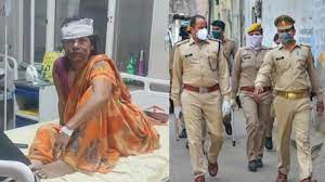 हीरा के पड़ोस में दलित महिला रहती थी, कपड़े उतारकर खाट से बांधा और एसिड उड़ेल दिया