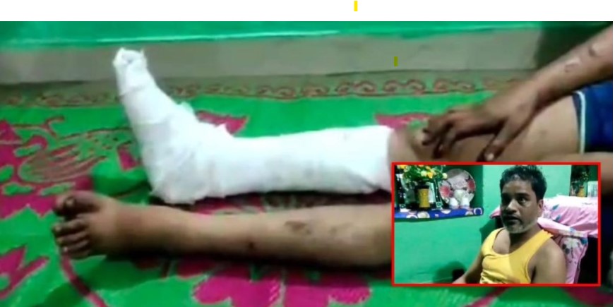 SP और दो TI को नोटिस जारी, ऑटो चालक से मारपीट कर पेशाब पिलाने का मामला