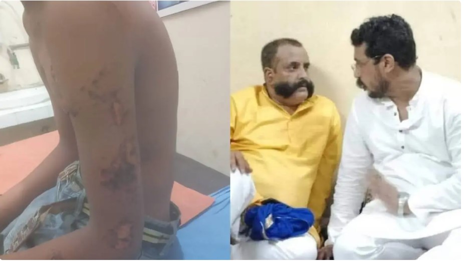 ड्राइवर ने दलित बच्चे के साथ की राक्षसों जैसी हैवानियत, रवि कुमार दलित बोले, कार्यवाही नहीं हुई तो होगा धरना प्रदर्शन