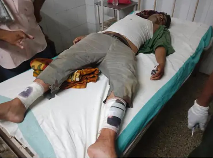 दलित युवक पर जानलेवा हमला:एसपी से शिकायत करके घर लौट रहा था, रास्ते में रोक आरोपियों ने जमकर पीटा