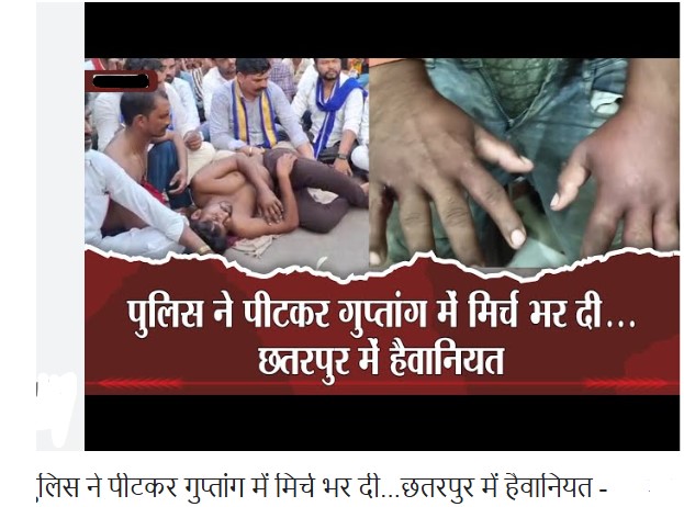 गुप्तांग में मिर्ची डाली, थाने में उल्टा लटकाकर पीटा:छतरपुर में चार युवकों का पुलिस पर आरोप; कहा- हमें लात-घूंसों और बेल्ट से मारा