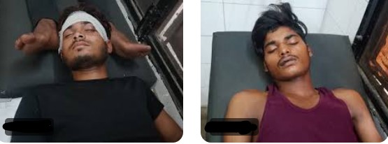 संभल में चोरी के शक में दलित युवकों को खंभे से बांधकर पीटा, वीडियो वायरल होने पर दर्ज हुआ मुकदमा