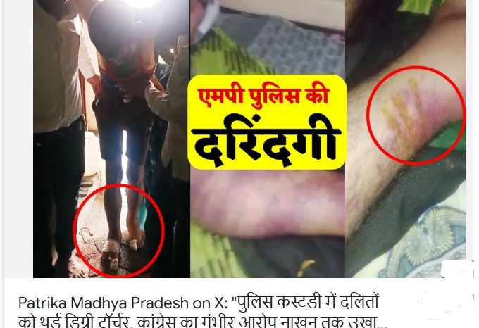 पुलिस कस्टडी में दलितों को थर्ड डिग्री टॉर्चर, कांग्रेस का गंभीर आरोप नाखून तक उखाड़े