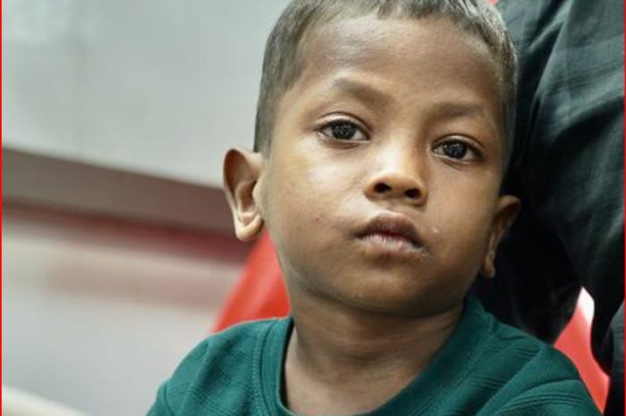 मध्य प्रदेश में महीनों तक आदिवासी बच्चे मरते रहे। सरकार को बहुत देर से होश आया।