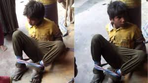 Shopkeeper kept beating Dalit boy all night, gave Taliban punishment for stealing and eating biscuits worth Rs 2
