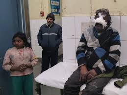 Father’s nose cut off while trying to save his son: People assaulted the child during playtime, case registered against 3