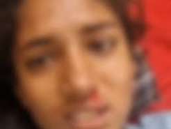 Dalit girl molested and assaulted: Family reaches SP office demanding arrests