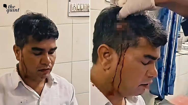 ‘Tu Sala N**ch’: Dalit Journalist Beaten In Udaipur, 2 FIRs Filed, 1 Against Him